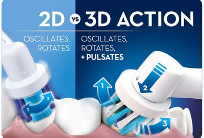 Oral-B 2D vs 3D